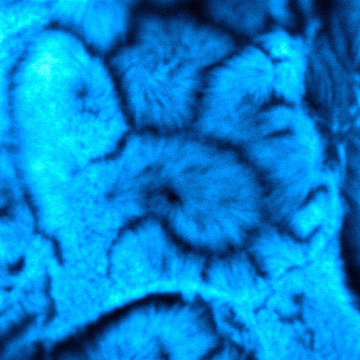 How to get better images #1Comparison:Confocal and STEDResult:Approximately an order of magnitude better resolution