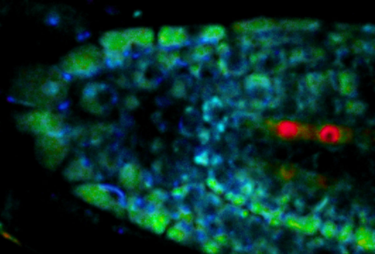 Live-cell sample of an Arabidopsis root tip suspended in water recorded with FACILITY. A subset of cells expresses a YFP construct. Lifetime imaging with TIMEBOW shows shifts in YFP fluorescence lifetime caused by the proteins nanoenvironment.We thank Dr. Fábián Attila and Soós Vilmos (ATK, Brunszvik, HU) for providing this sample. Contact: soos.vilmos@atk.hu.